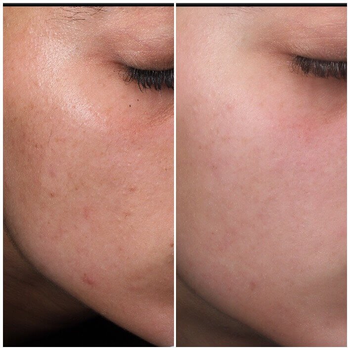 44F8C1F9-0684-4D11-8D5F-3FE984B19CDB